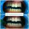 IGIENE DENTALE E SBIANCAMENTO CLICK BLANCONE.